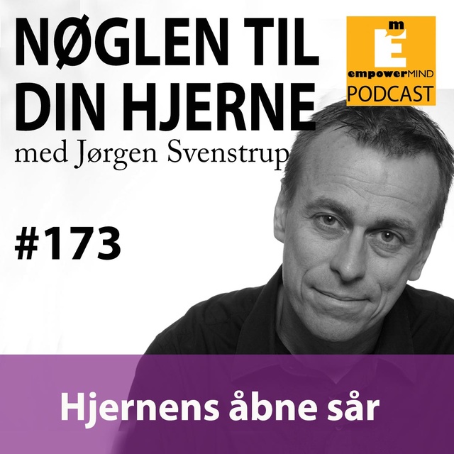 #173 Hjernens åbne sår