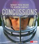 What You Need to Know about Concussions